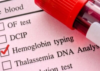 Krijg je genoeg ijzer binnen bij een plantaardig dieet?