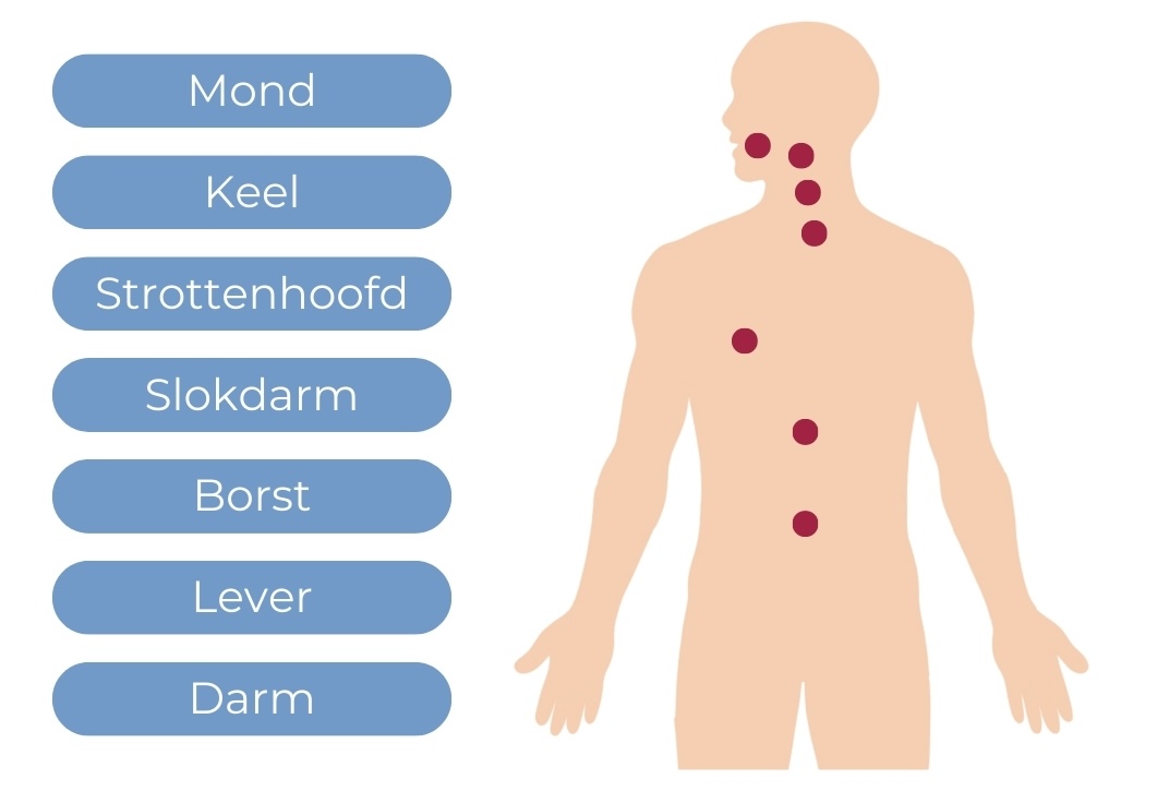 Alcohol en kanker